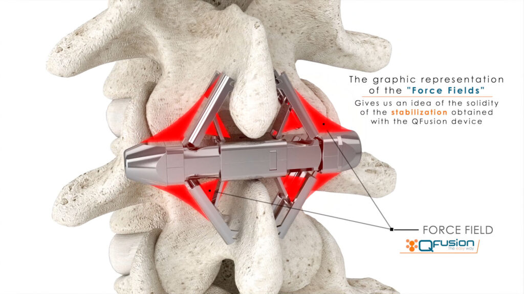 QFusion7